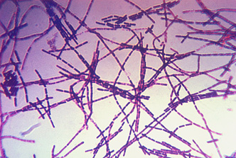A photomicrograph of Bacillus anthracis bacteria using Gram stain technique. Anthrax is diagnosed by isolating B. anthracis from the blood, skin lesions, or respiratory secretions or by measuring specific antibodies in the blood of persons with suspected cases.