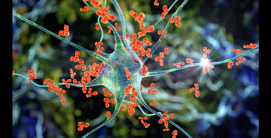 Antibodies attacking neuron, 3D illustration. Concept of autoimmune neurologic diseases. IIlustration by: Kateryna Kon (ASU)